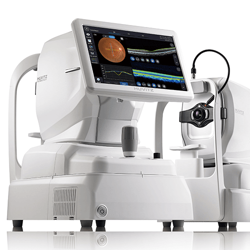 HOCT-1/1F: All-in-One Optical Coherence Tomography for comprehensive retinal diagnostics.