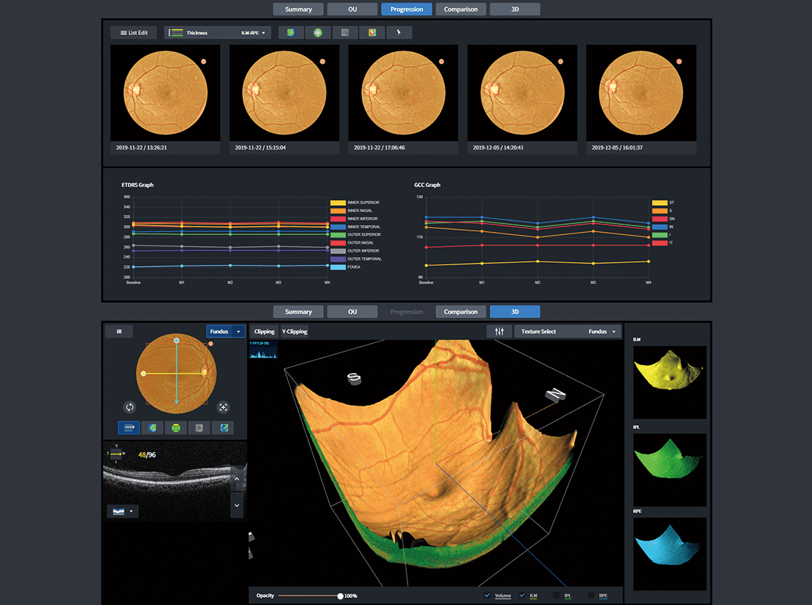 Screenshots showing Macular / Progression , Macular / 3D