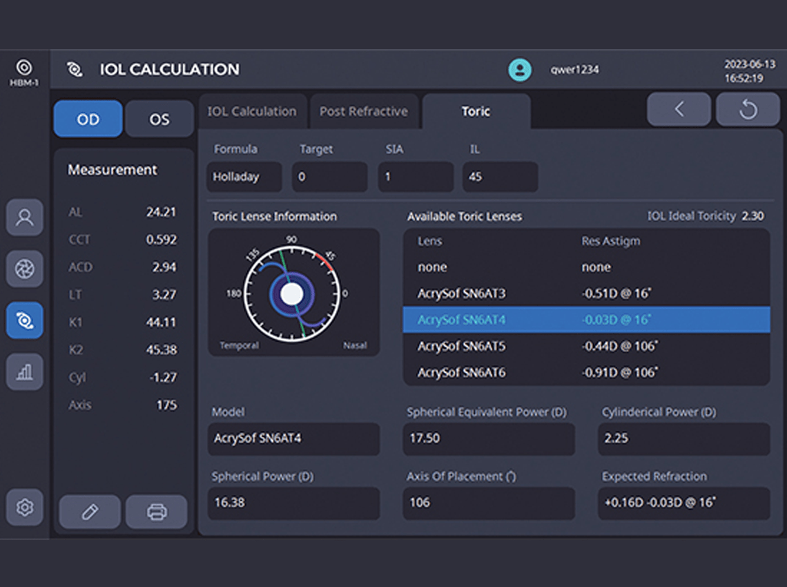 Screenshot of Toric IOL Prescription