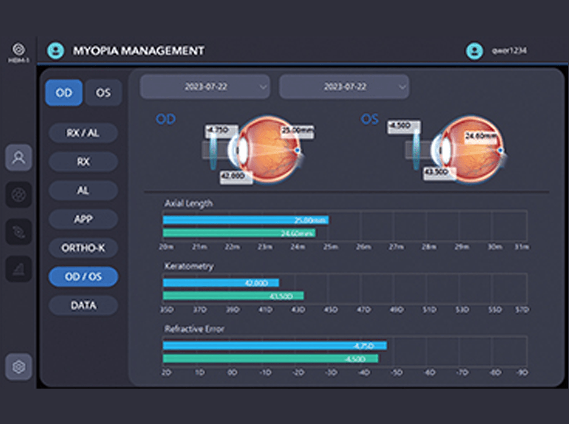 Screenshot showing anisometropia assessment of the HBM-1