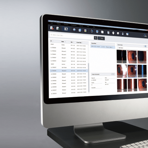 HIS-5000: Huvitz Imaging System providing high-quality image and video capture for slit lamp microscopes.
