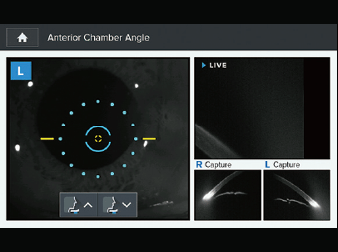 Screenshot of CCT Measurement and IOP Compensation on the HNT-1/1P
