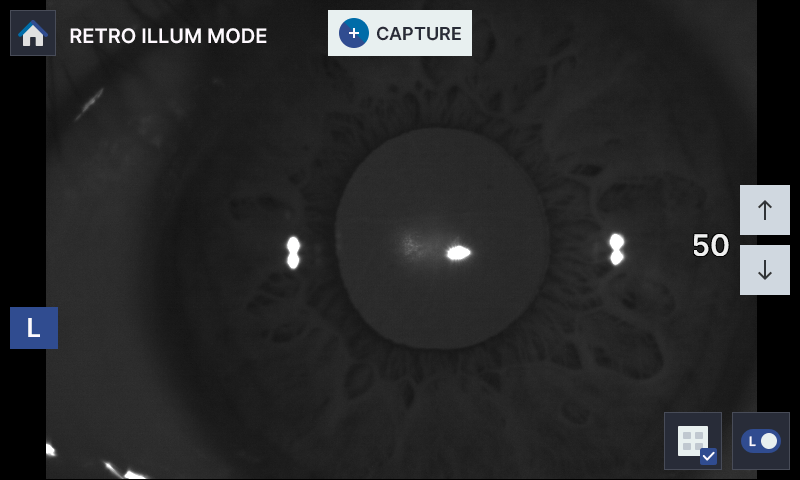 Image of detailed eye health analysis using HRK-8100A