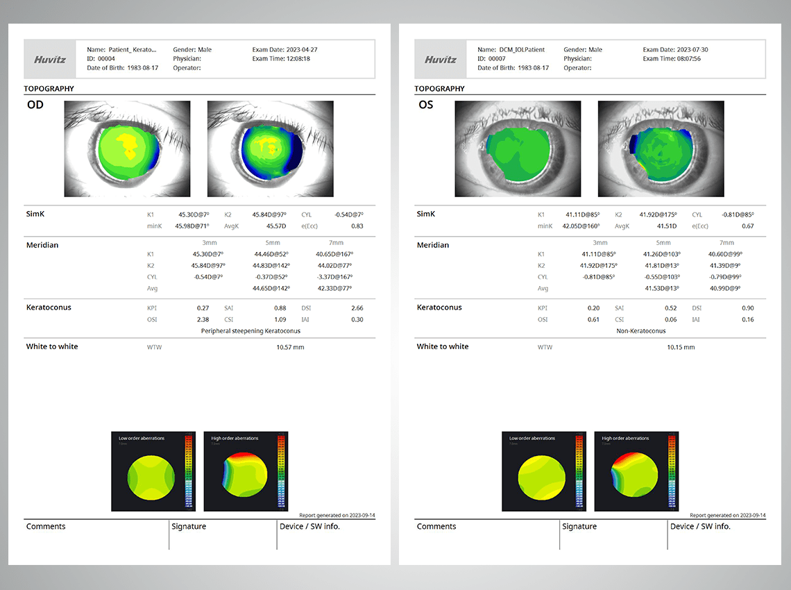Corneal data report measured by HTG-1