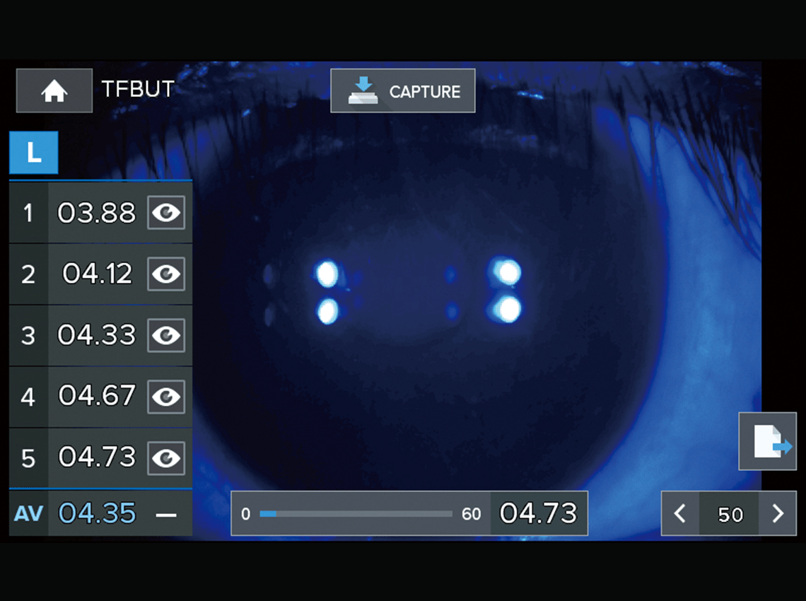 Screenshot of TFBUT(Tear film break up time) on the HTR-1A