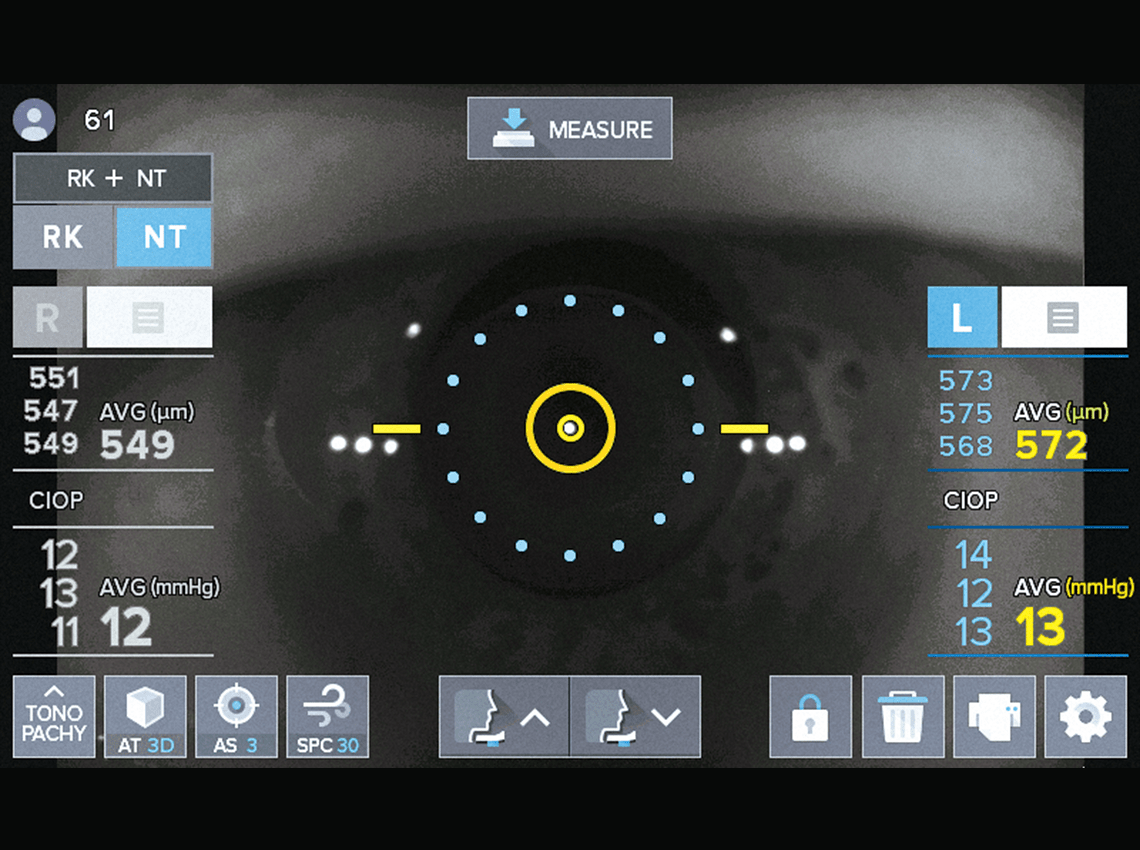 Screenshot of Peripheral Keratometry Measurement on the HTR-1A