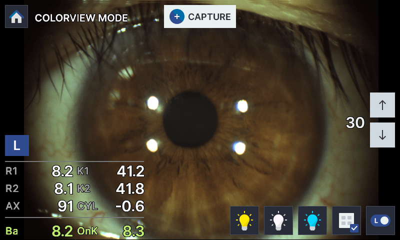 Image of detailed eye health analysis using HRK-8100A