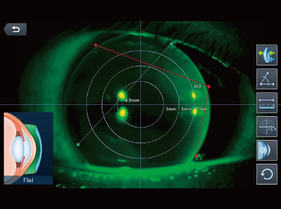 Image showing a close-up of an eye undergoing an eye exam