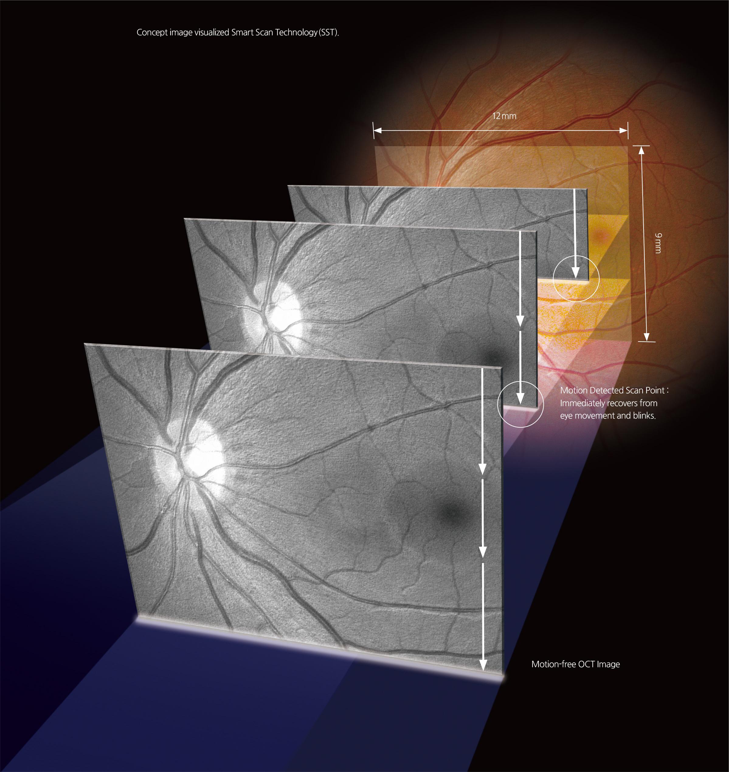 Image of Optical Coherence Tomography