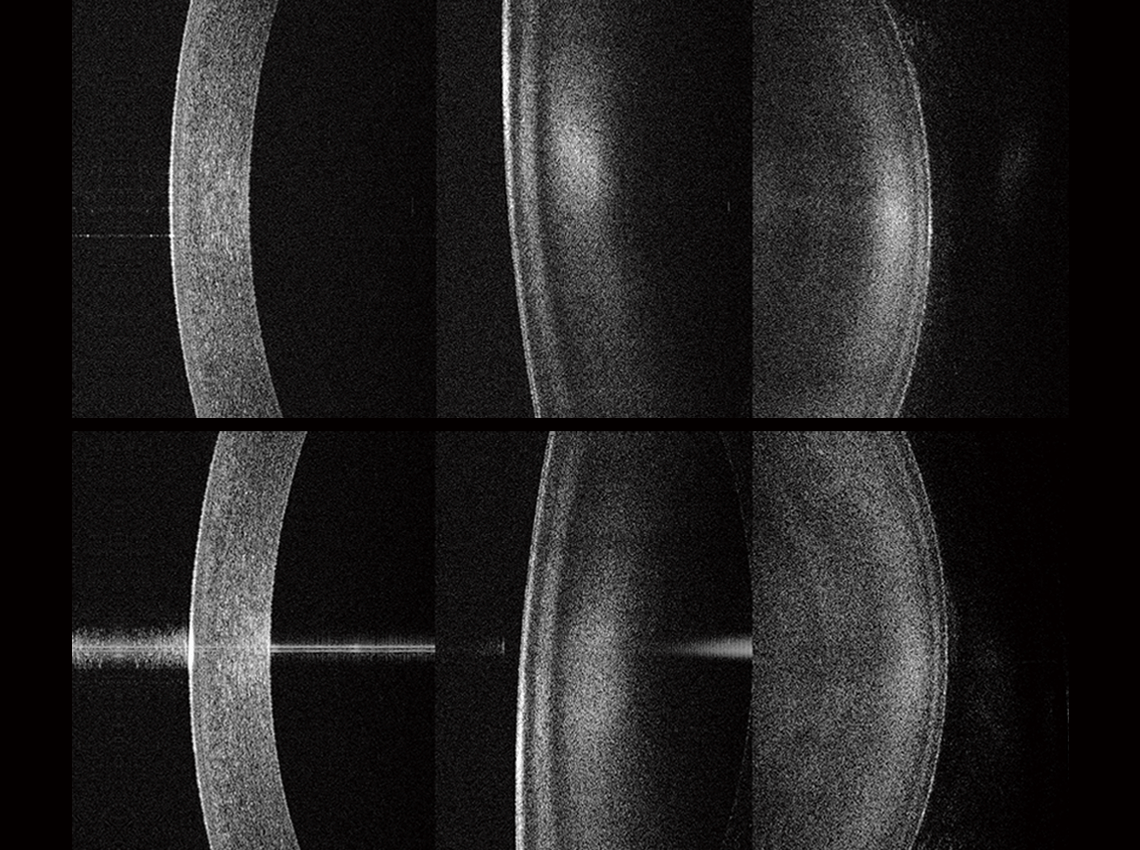 The corneal cross-section photograph