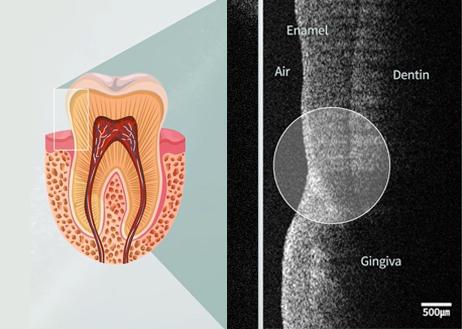 Image showing illustrations and photographs of cross-sections of teeth