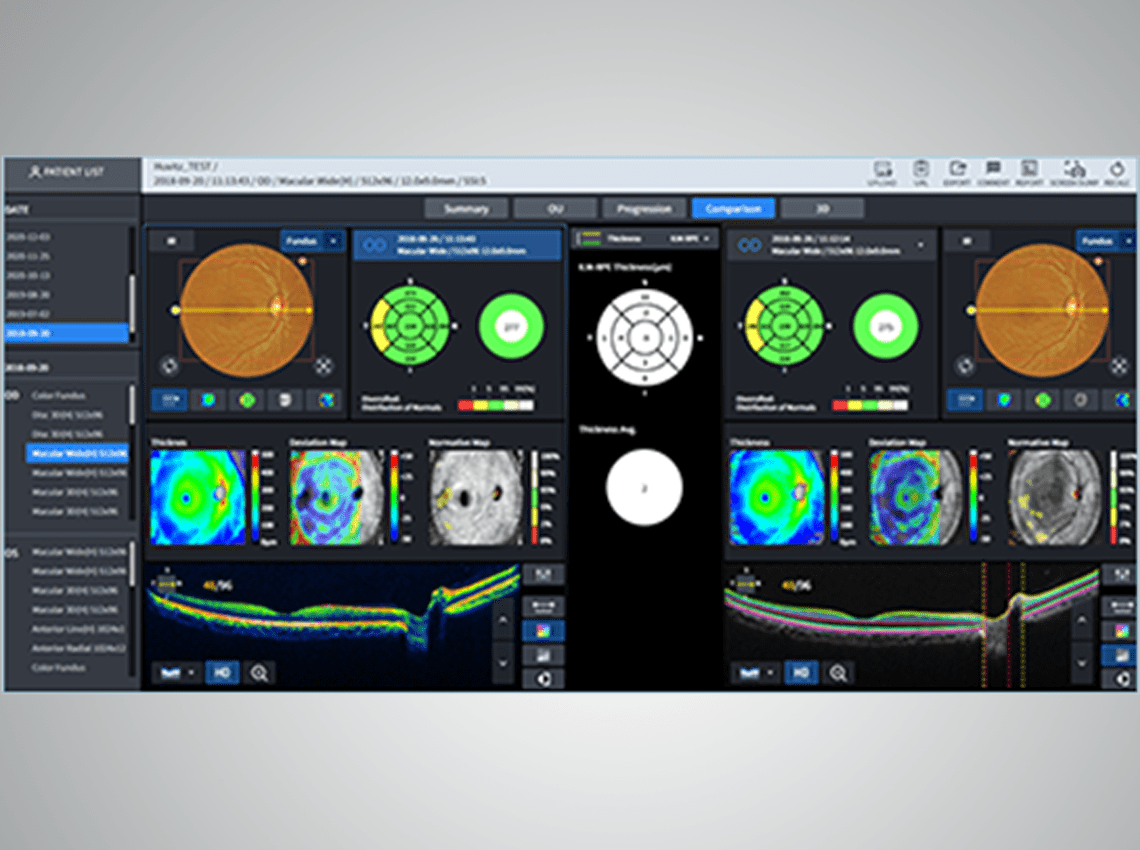 Screenshot showing Comparison information
