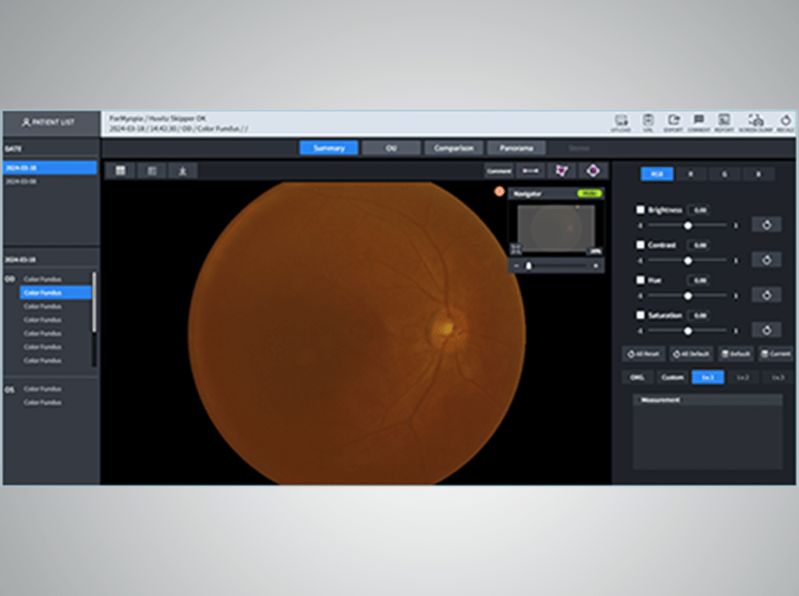 Image showing Color Fundus information