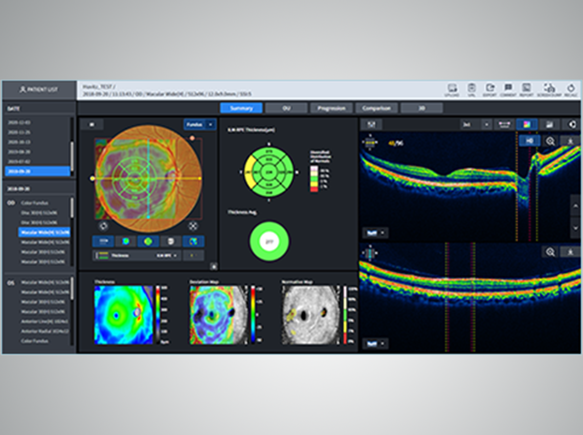 Image showing Macular information