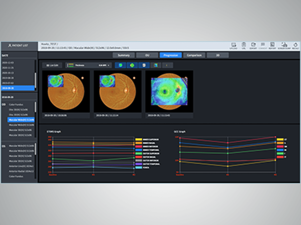 Screenshot showing Progression information