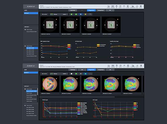 Tiến trình đĩa 3D