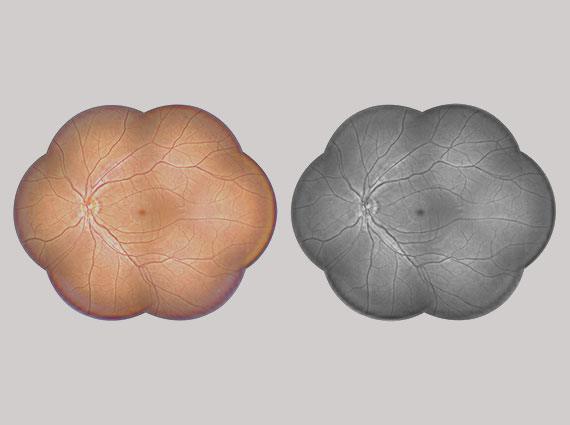 Fundus panorama Level 4/Grey