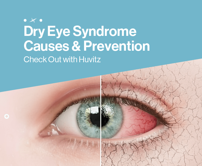 Dry Eye Syndrome
