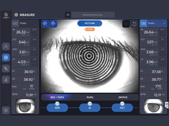 Measurement of 10 Key Parameters