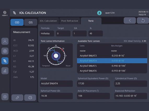 Toric IOL Selection