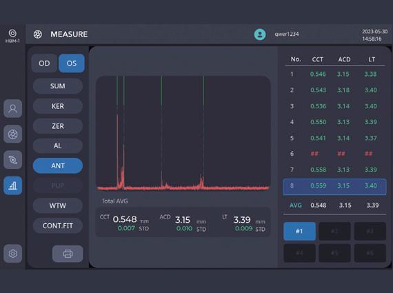 CCT, ACD, and LT Measurements