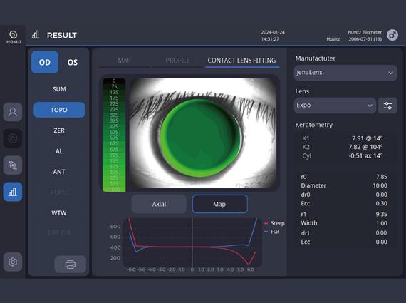 Contact Lens Fitting