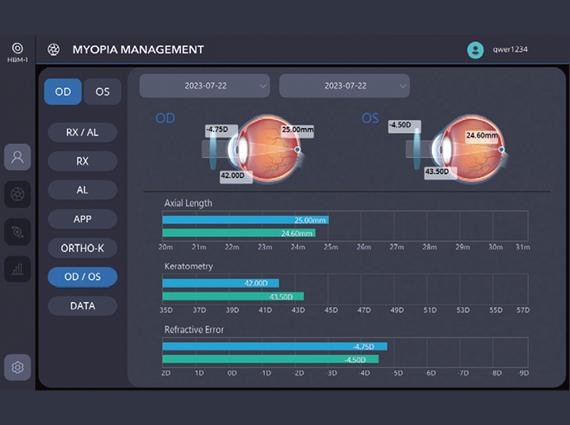 Anisometropia Assessment