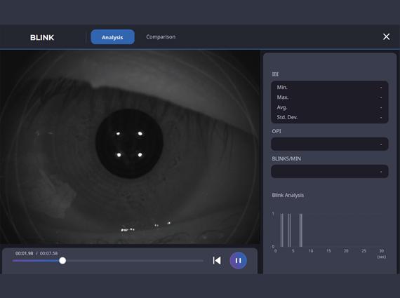 Blink Analysis