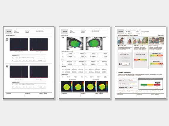 Report : Biometry, Topography, Myopia